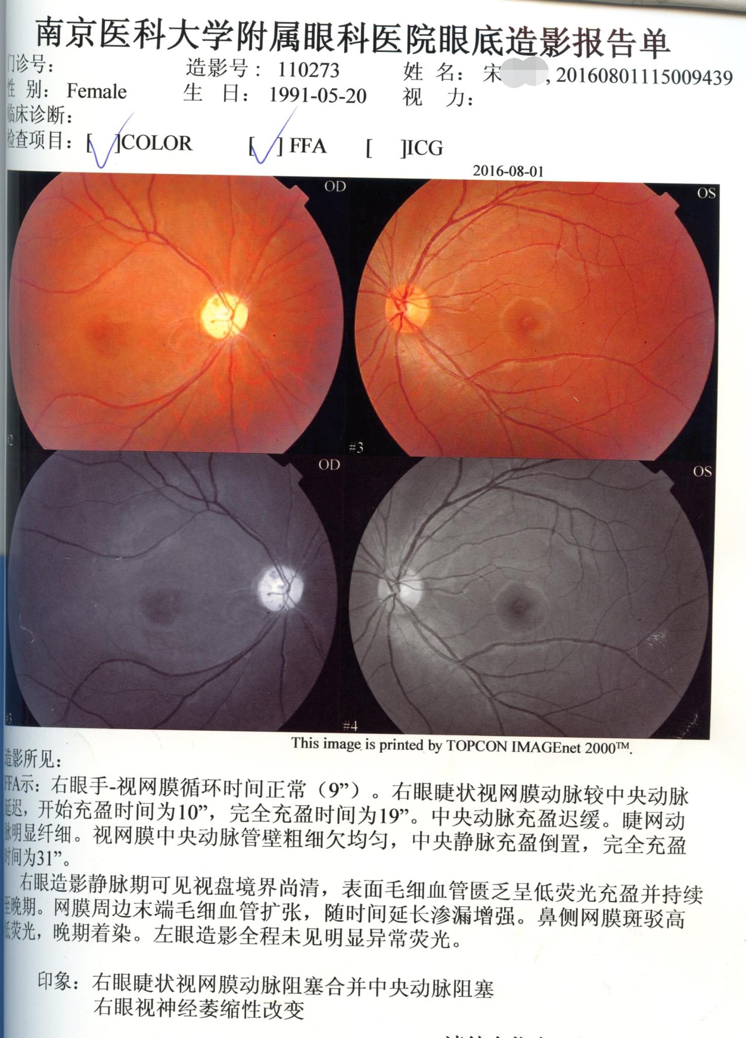 宋某眼底造影