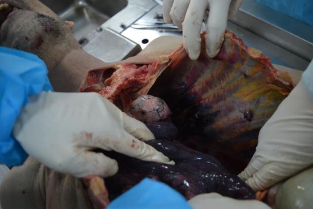 福建正扬司法鉴定所对孙必让死因法医学鉴定